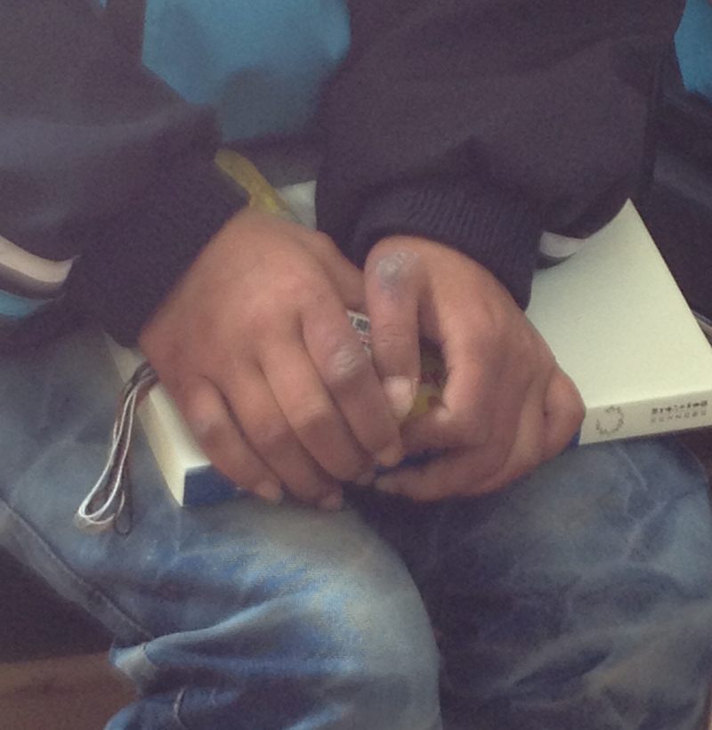 初一女生吳同學被凍傷的小手